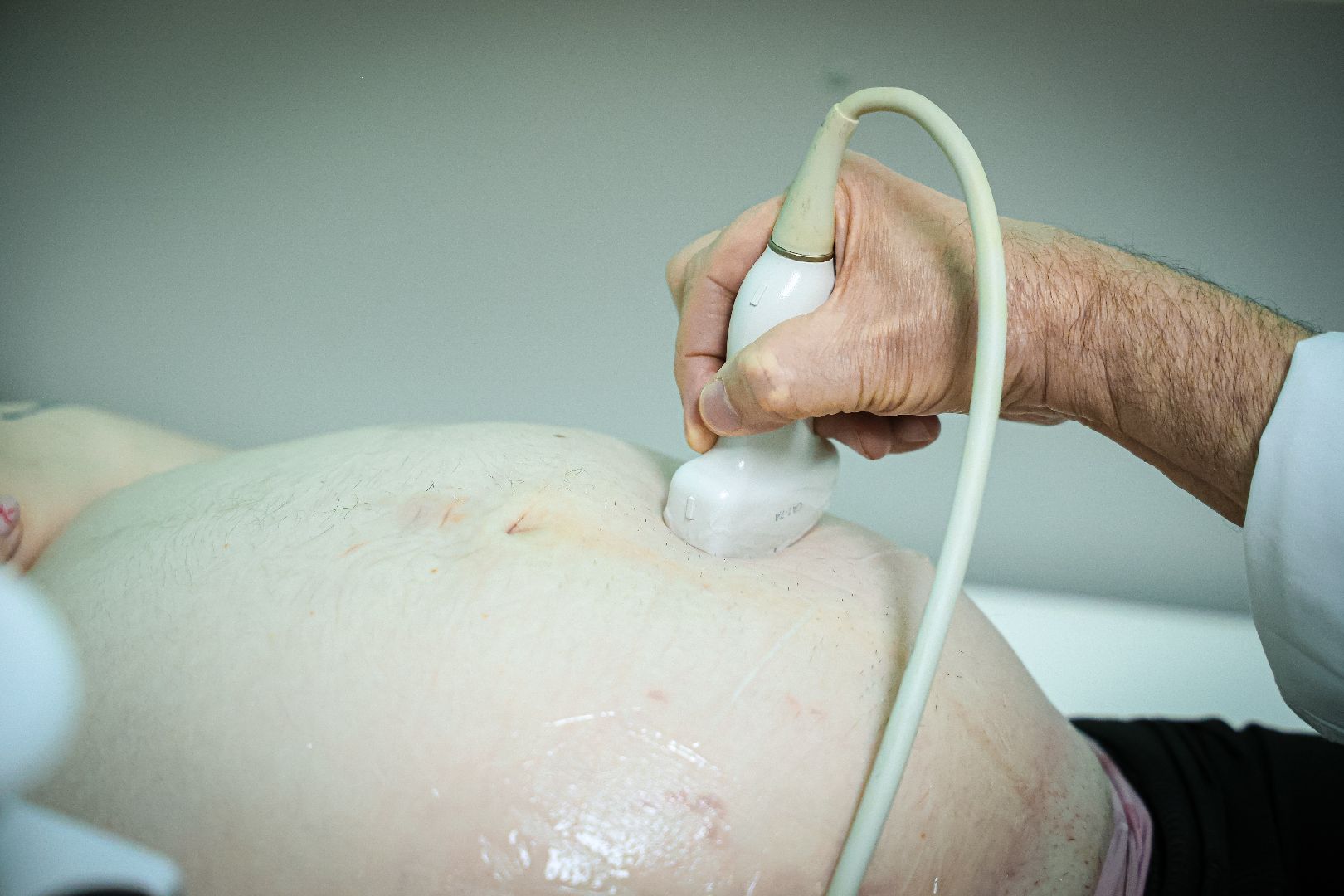 клин, медицина, семьи, подмосковье, роды в подмосковье,