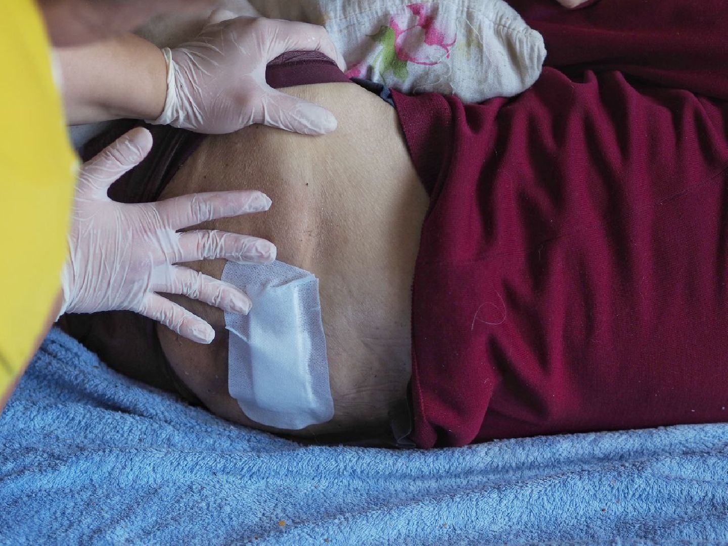 Долгопрудный, патронаж, медицина, больные, сиделка