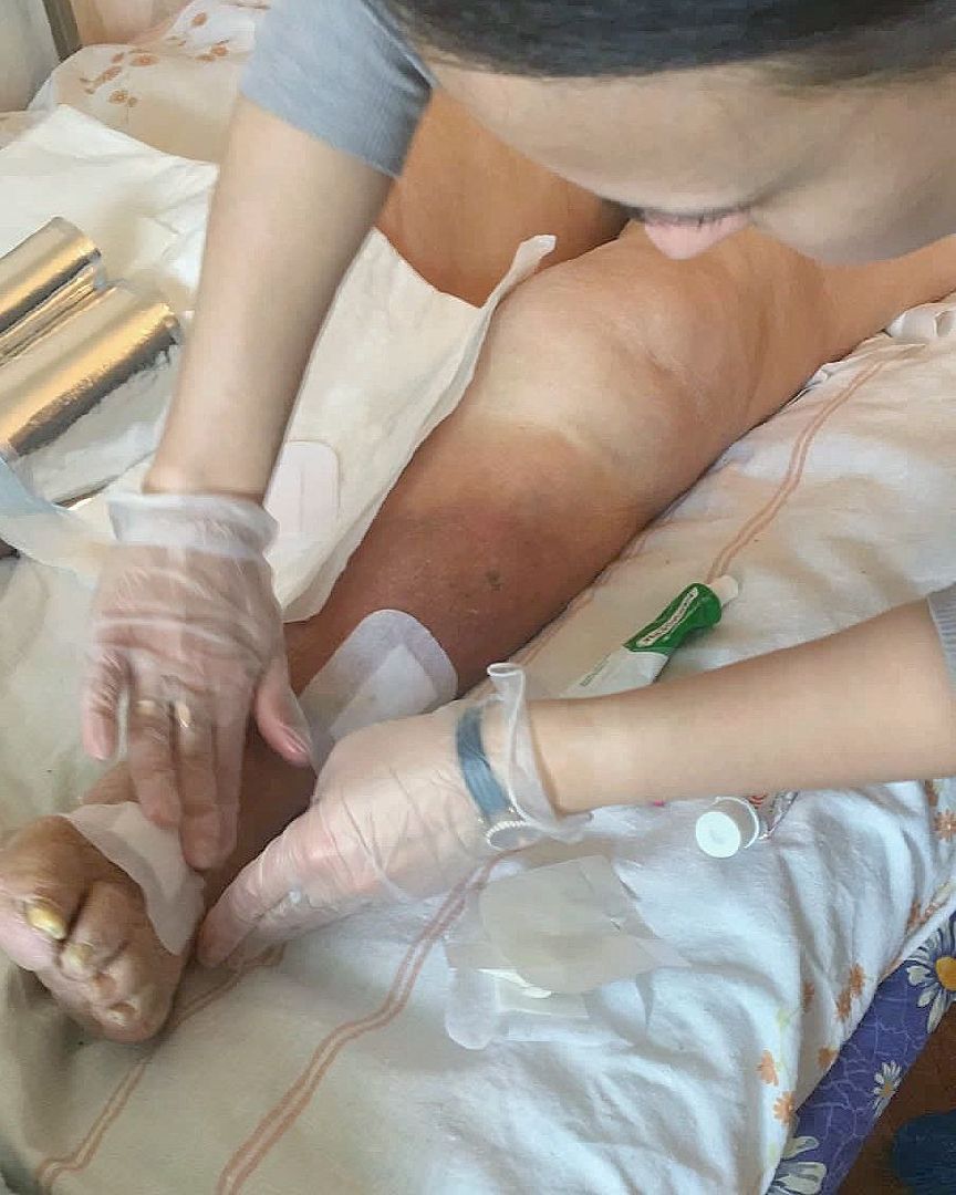 Долгопрудный, патронаж, медицина, больные, сиделка